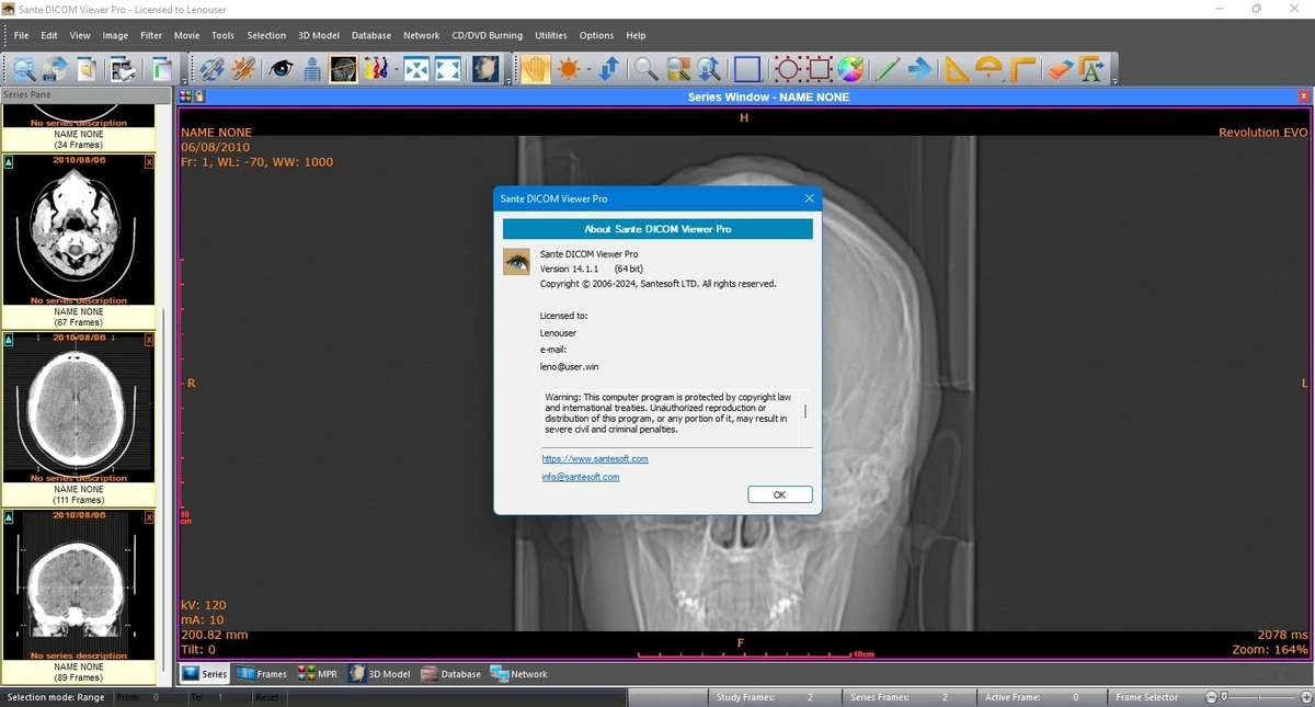 Просмотр DICOM Sante DICOM Viewer Pro 14.1.1 — изображение 2
