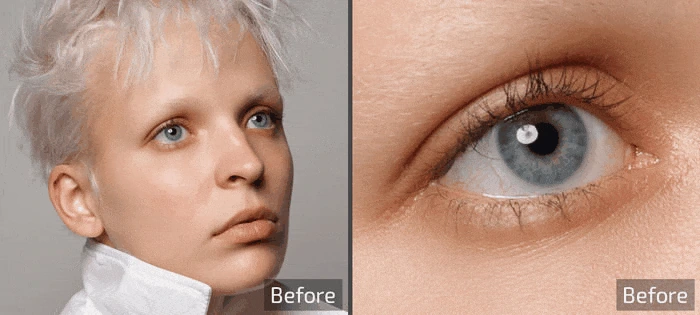 Retouch4me Eye Vessels 0.993 Patched — изображение 2