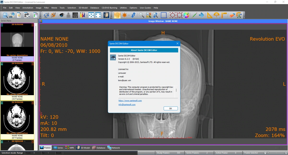Sante DICOM Edtor 8.2.5 — изображение 2