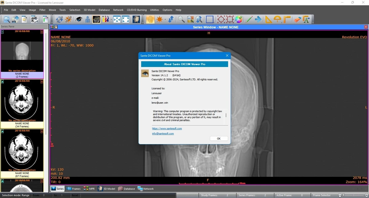Sante DICOM Viewer Pro 14.1.2 — изображение 2