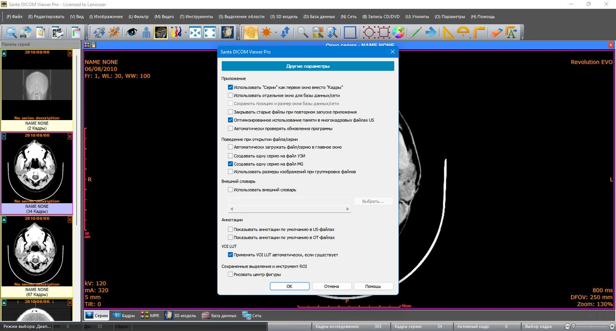 Sante DICOM Viewer Pro 14.2.2 — изображение 3