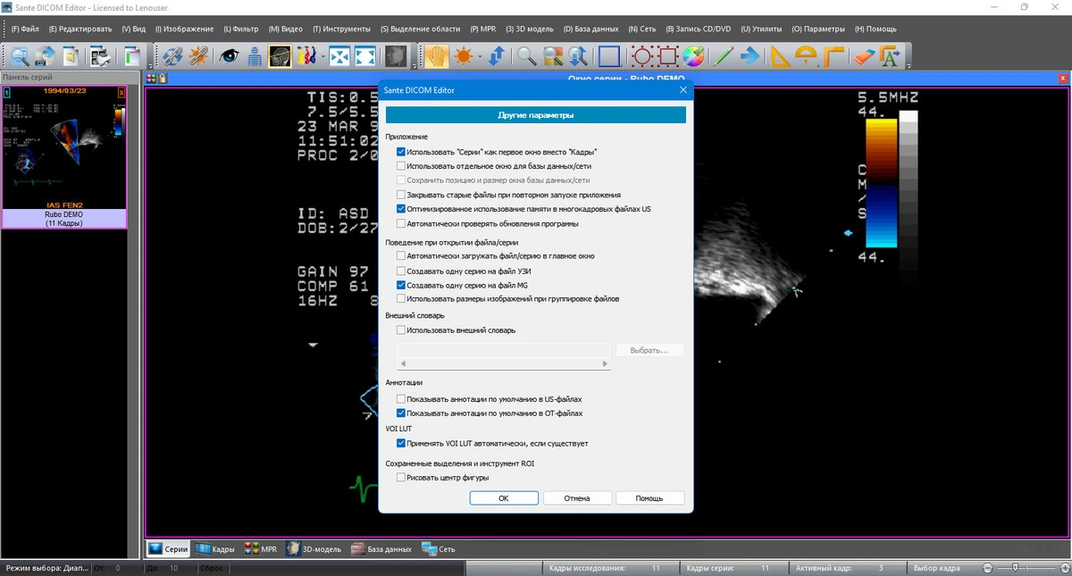 Sante DICOM Editor 10.2.2 — изображение 3