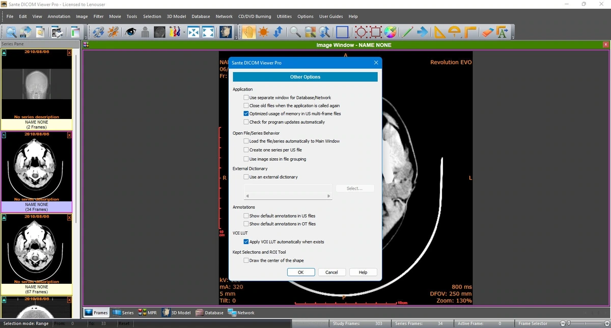 Sante DICOM Viewer Pro 14.1.2 — изображение 3